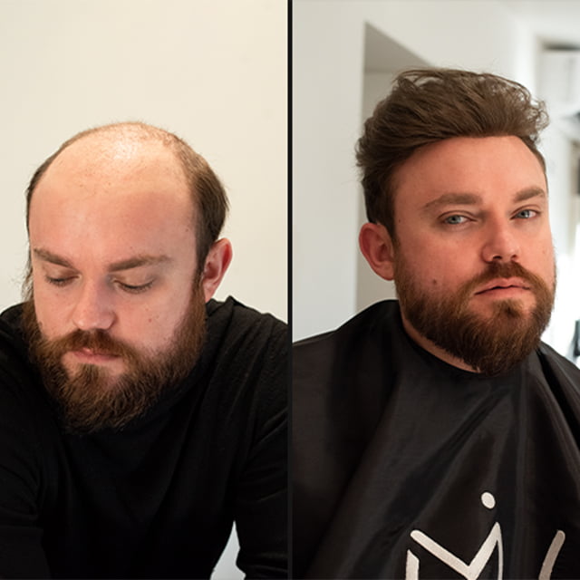 Avant / Après